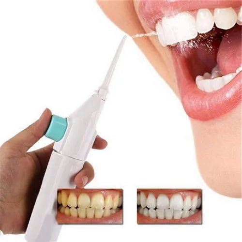 Irrigador Bucal Limpieza Profunda - CleanTeeth™