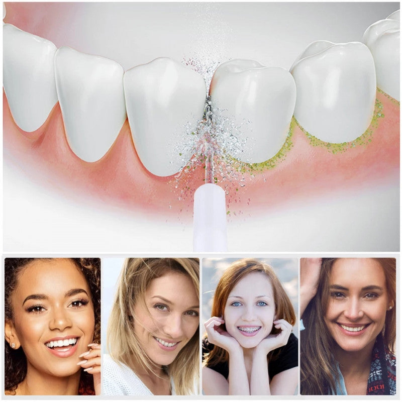 Irrigador Bucal Limpieza Profunda - CleanTeeth™