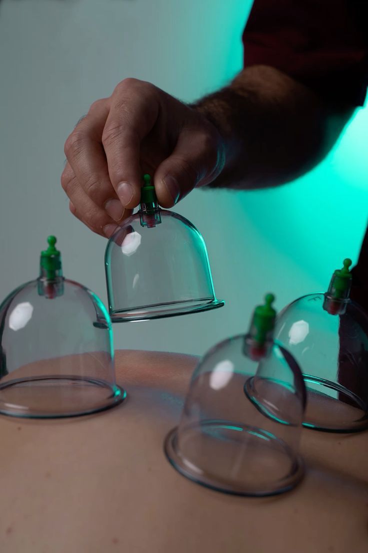 Cupping therapy - Ventosas