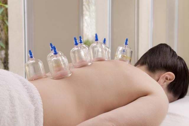 Cupping therapy - Ventosas